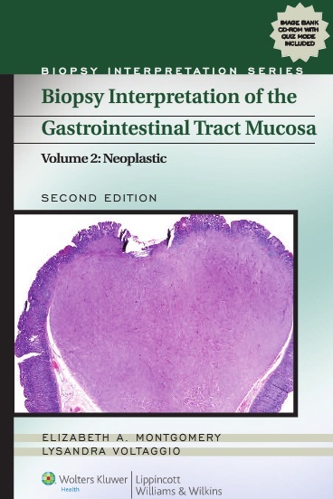 biopsy-interpretation-of-the-gastrointestinal-tract-mucosa-vol-2-neoplastic
